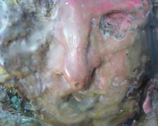 "bruised man" by anna bogighian collection napoleon brousseau